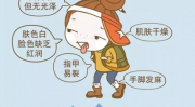 血虚的症状有哪些,面色苍白、头晕乏力等常见表现